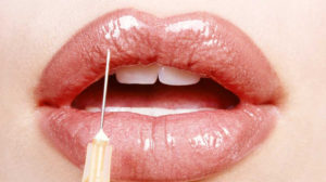 Injecting lips - for article on Botox and fillers