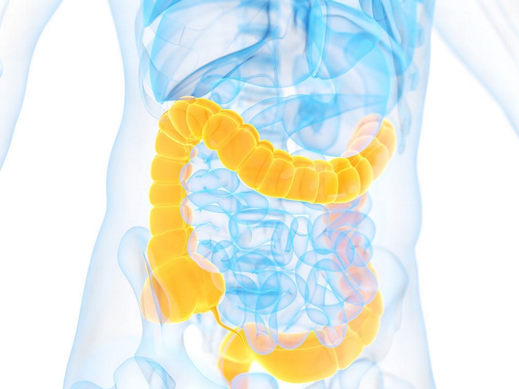 Colon cancer is the fourth most prevalent cancer in the world, Hong Kong