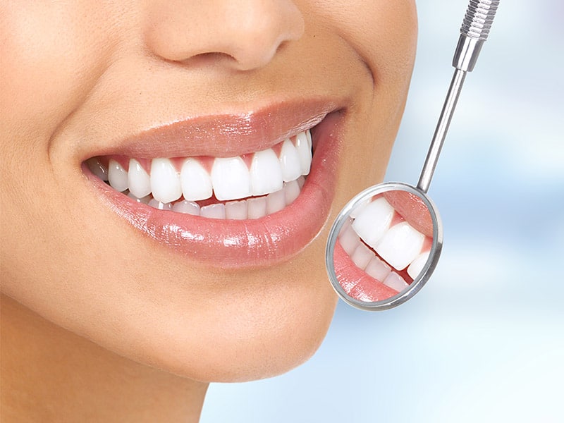 Dental and teeth whitening