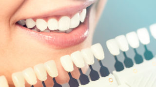 Cosmetic dentistry - teeth whitening, porcelain veneers, implants
